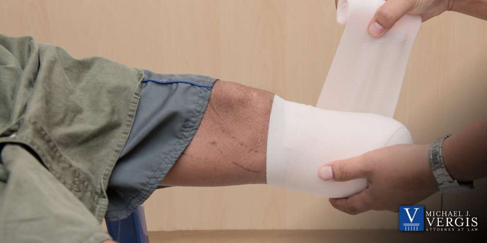 Accidental Amputation Lawyer in Louisiana